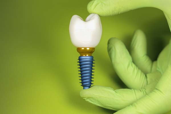 How To Take Care Of Dental Implants 