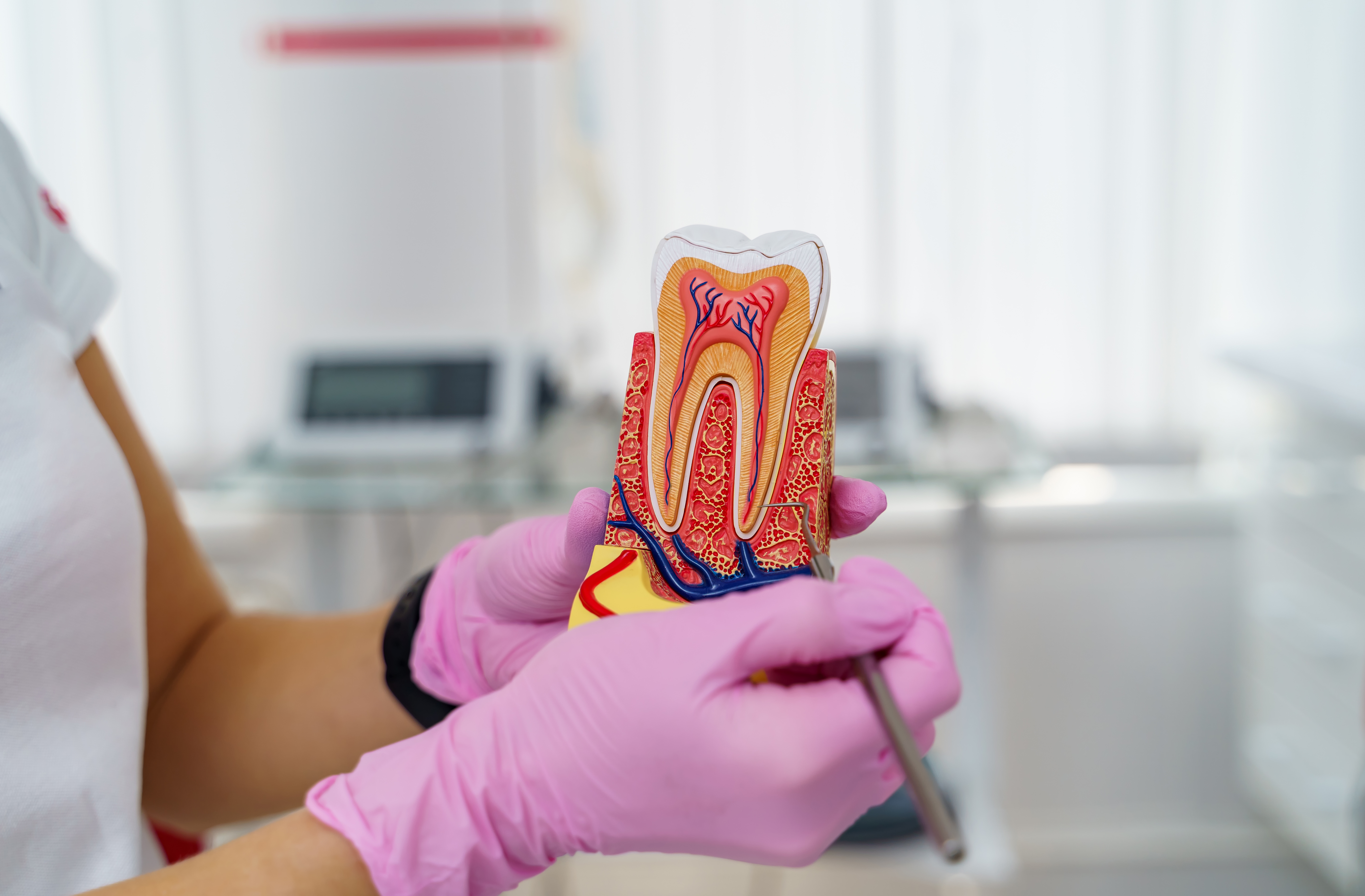 When Root Canal Therapy May Be Recommended